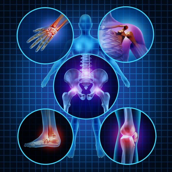 Joint-Pain-Bellevue-WA